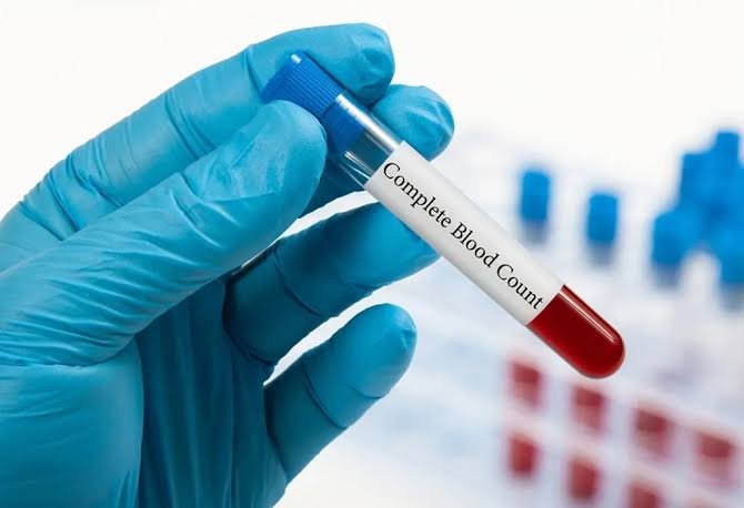 Complete Blood Count test